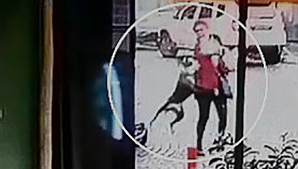 Tekirdağda Pitbull Dehşeti Kamerada: Hem Ona Hem De Köpeğine Saldırdı