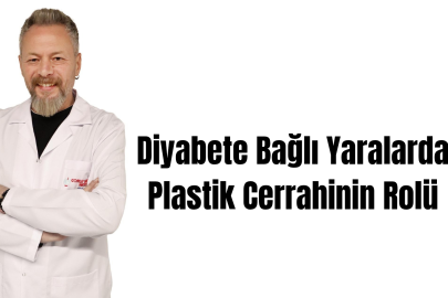 Diyabete Bağlı Yaralarda Plastik Cerrahinin Rolü